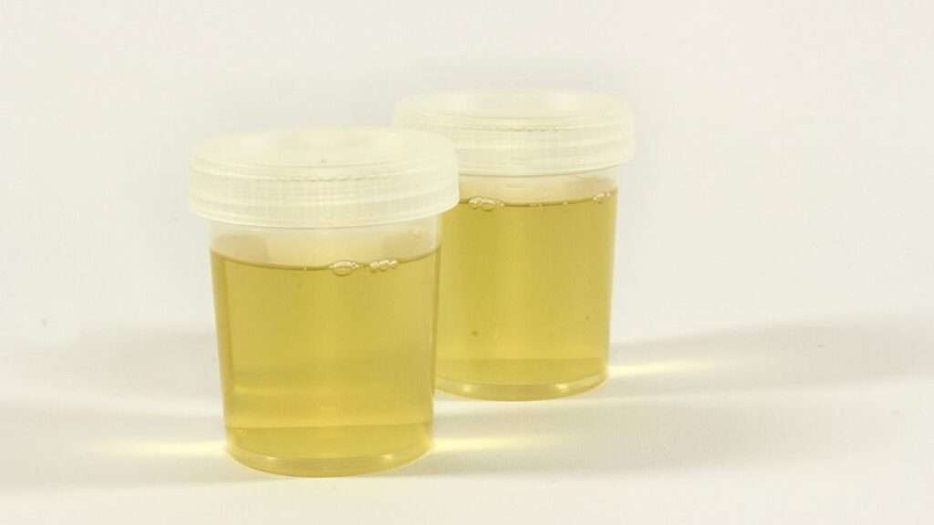 Unlocking the Secrets of Walgreens Synthetic Urine A Comprehensive