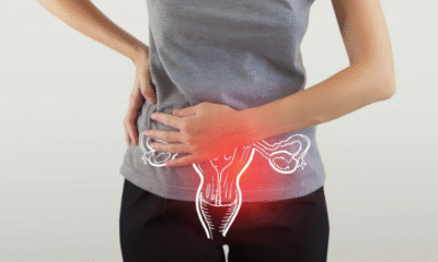 Modern Medicine Work Together for PCOD Treatment