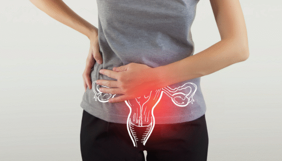 Modern Medicine Work Together for PCOD Treatment