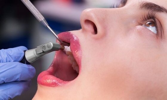 Pros Of Visiting A Dentist Often