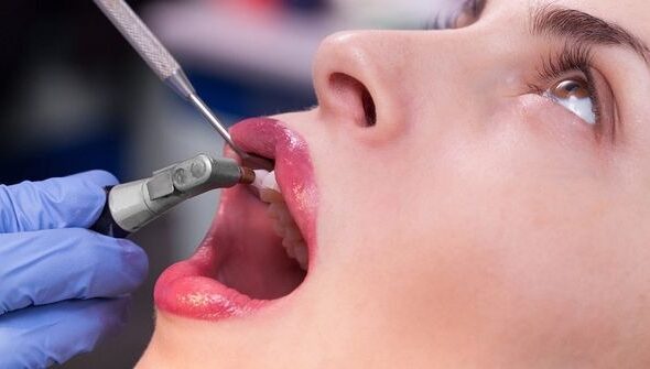 Pros Of Visiting A Dentist Often
