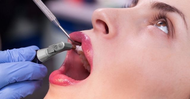 Pros Of Visiting A Dentist Often