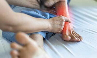 Ankle Replacements