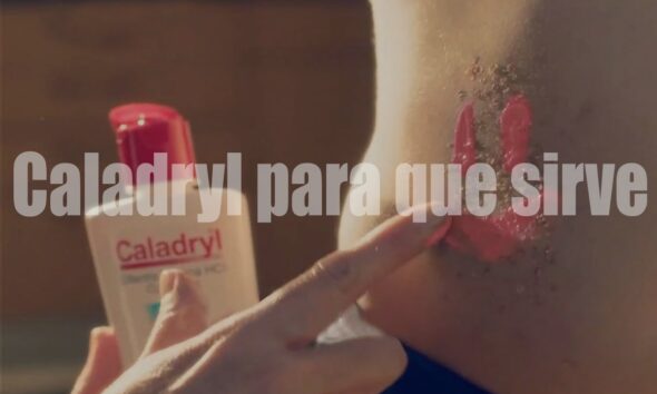 Caladryl para que sirve: Your Go-To Solution for Skin Relief