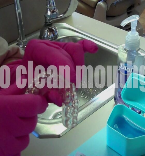 How to how to clean mouthguard: The Complete Guide