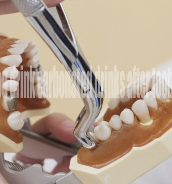 When Can You Drink Carbonated Drinks After Tooth Extraction?
