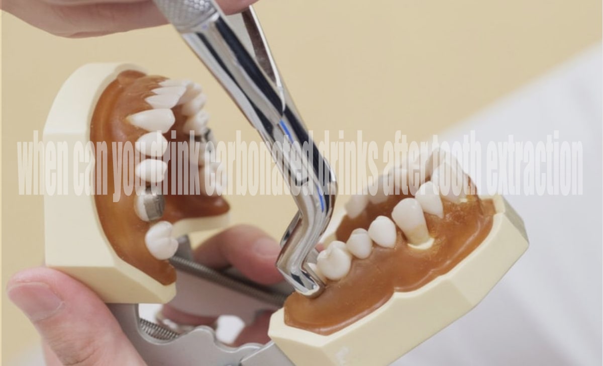 When Can You Drink Carbonated Drinks After Tooth Extraction?