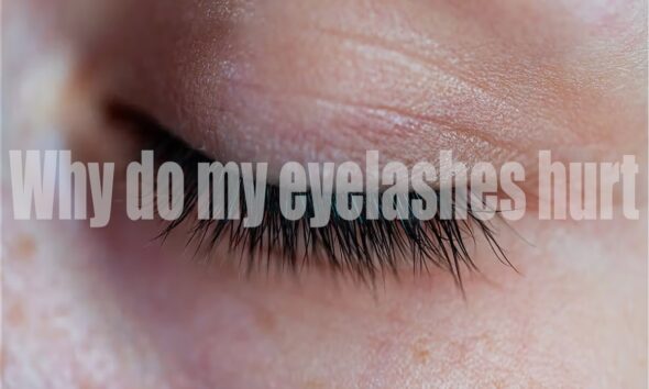 Why Do My Eyelashes Hurt? Causes, Remedies, and Prevention