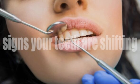 5 Signs Your Teeth Are Shifting (And What to Do About It)